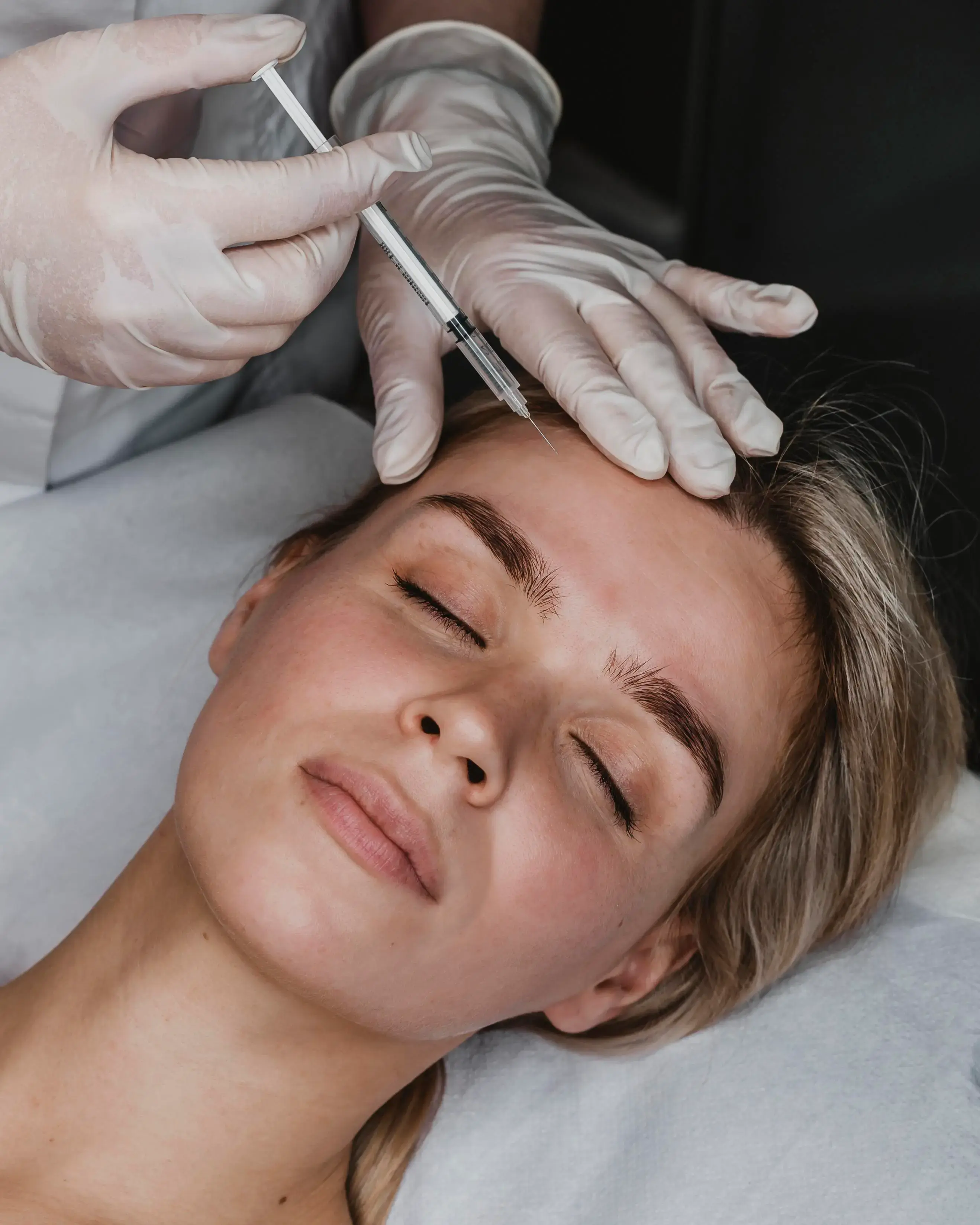 Botox aesthetic treatment
